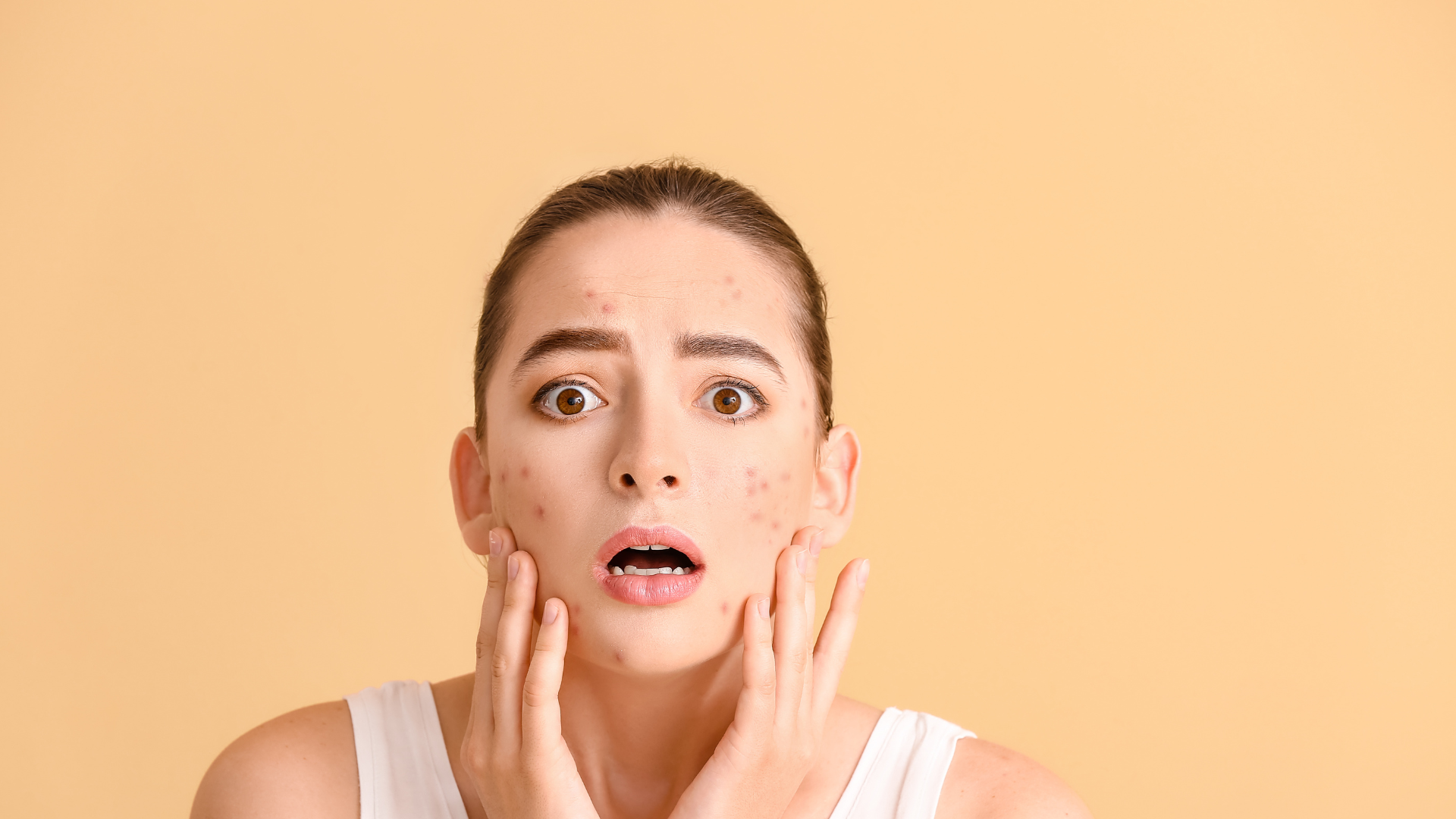 Remove pimples with neem and coconut oil