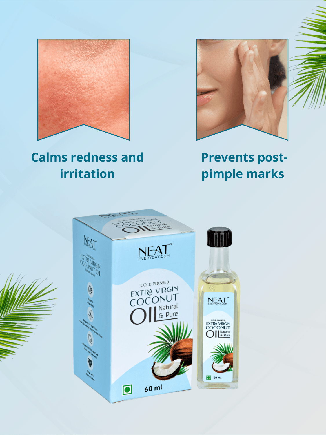 Spot Treatment Oil for Acne, Blemishes & Clear Skin calms redness and irritation while preventing post-pimple marks with natural coconut oil.