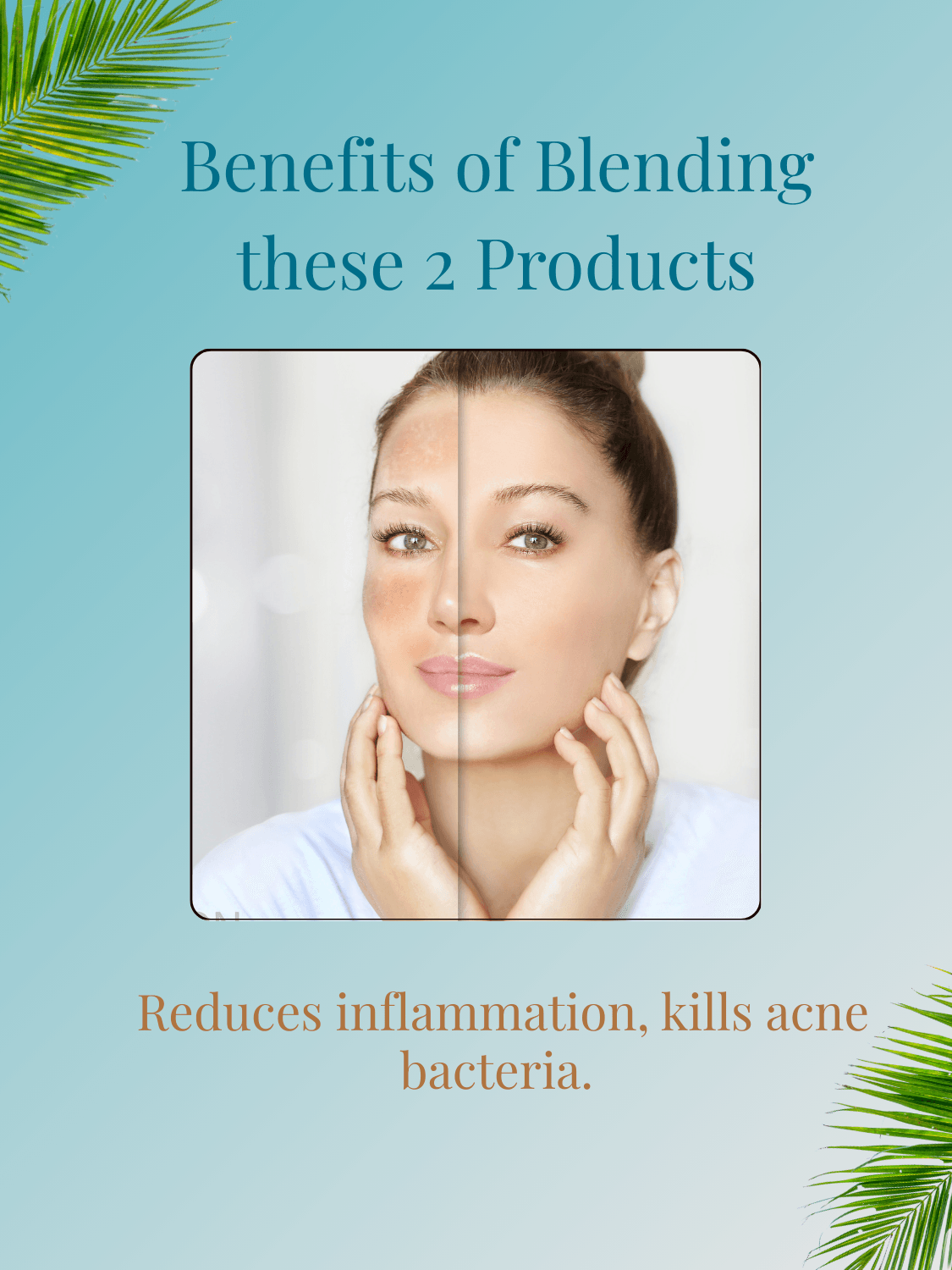 Spot Treatment Oil for Acne, Blemishes & Clear Skin bundle blends neem and coconut oil to reduce inflammation and eliminate acne-causing bacteria.