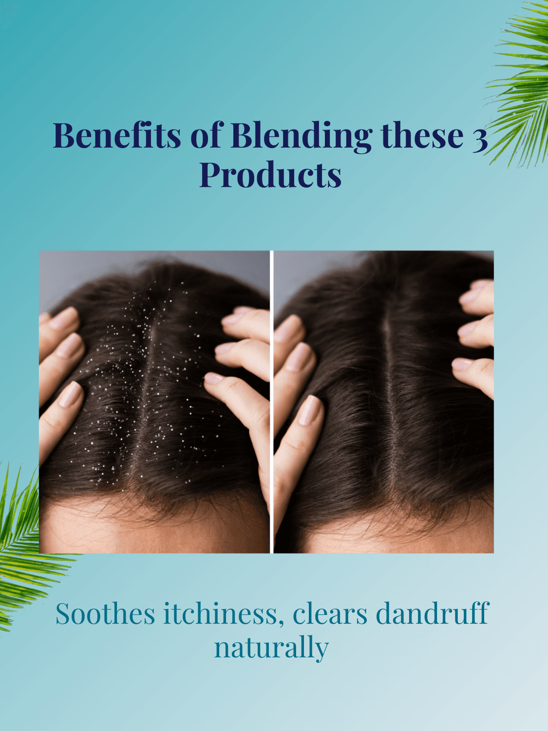 Before and after scalp images showing dandruff reduction using Anti-Dandruff Hair Mask – Scalp Care bundle with natural soothing ingredients.